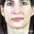 Dr. Amani Khasawneh Implantologist in Dubai