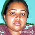 Dr. Farhana Tarannum Dentist in Bangalore