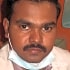 Dr. Mohan Raj V Dentist in Bangalore