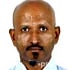 Dr. P C Tejaswi Ophthalmologist/ Eye Surgeon in Bangalore