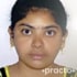 Ms. Barla Padma   (Physiotherapist) Physiotherapist in Hyderabad