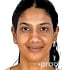 Ms. Ishita Jindal   (Physiotherapist) Physiotherapist in Claim_profile