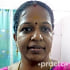 Ms. Sri Kalpana Kannan   (Physiotherapist) Physiotherapist in Chennai